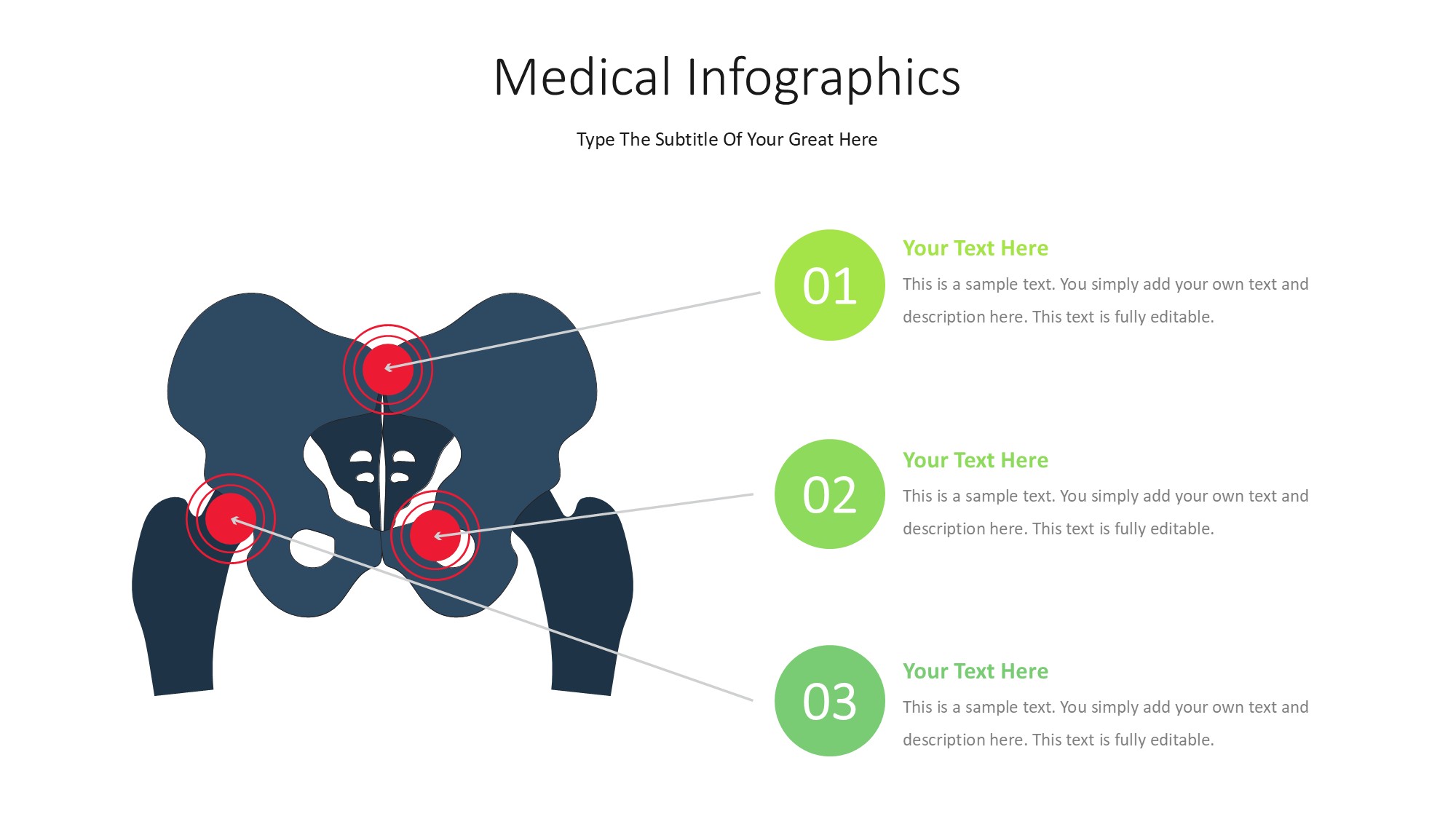 医疗医药图形信息图示PPT模板